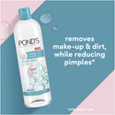 Pond's Pimple Clear Micellar Water, 13.52oz. (400ml)